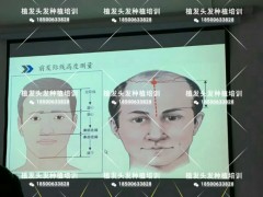 哪里可以学习植发技术,哪里教植发好