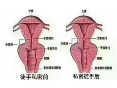 北京昕蝶欧一指私密培训术全国招生